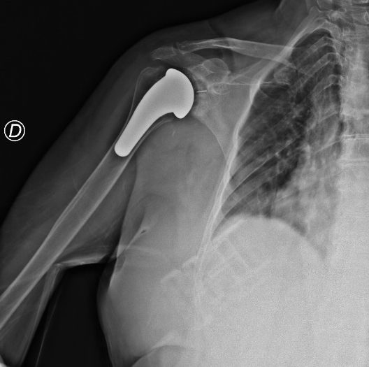 schermata-2017-02-10-alle-15-35-20